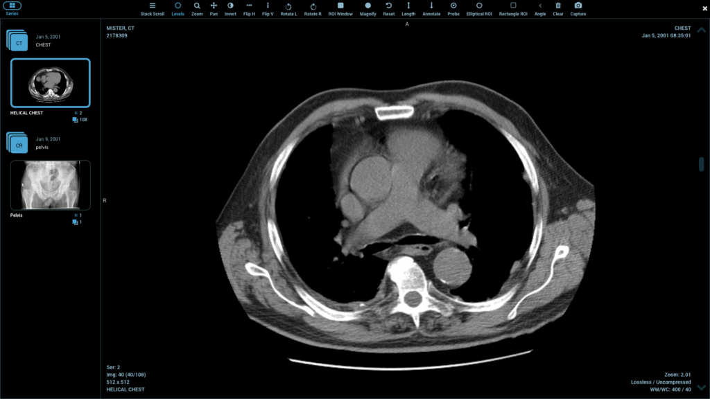 DICOM medical image viewer