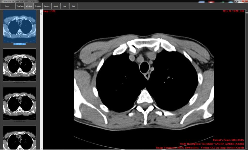 DICOM medical image viewer